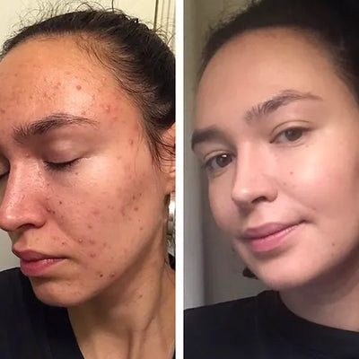 Madison, 37