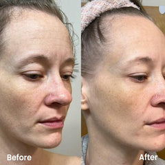 Before and after comparison of a person's face with visible skin texture differences.